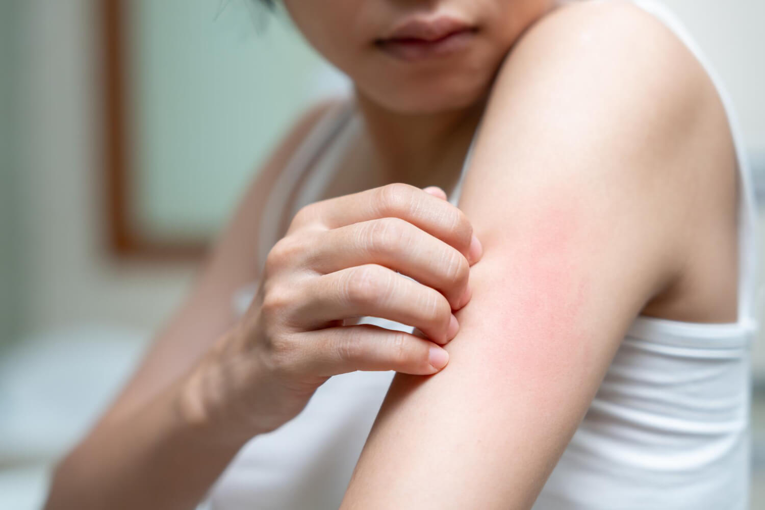 alergia na nikiel objawy